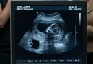 My Husband Tried To Take The House After Calling My Pregnancy Impossible But The Ultrasound Changed Everything